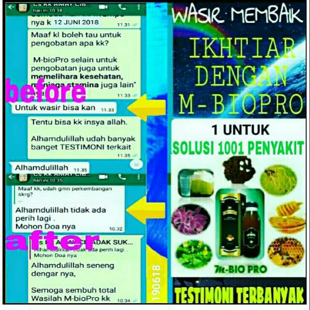 Terbaik M Biopro Herbal Untuk Wasir Ambeien Ambeyen Diabetes Gula Darah Kesemutan Pegel Pegel Shopee Indonesia