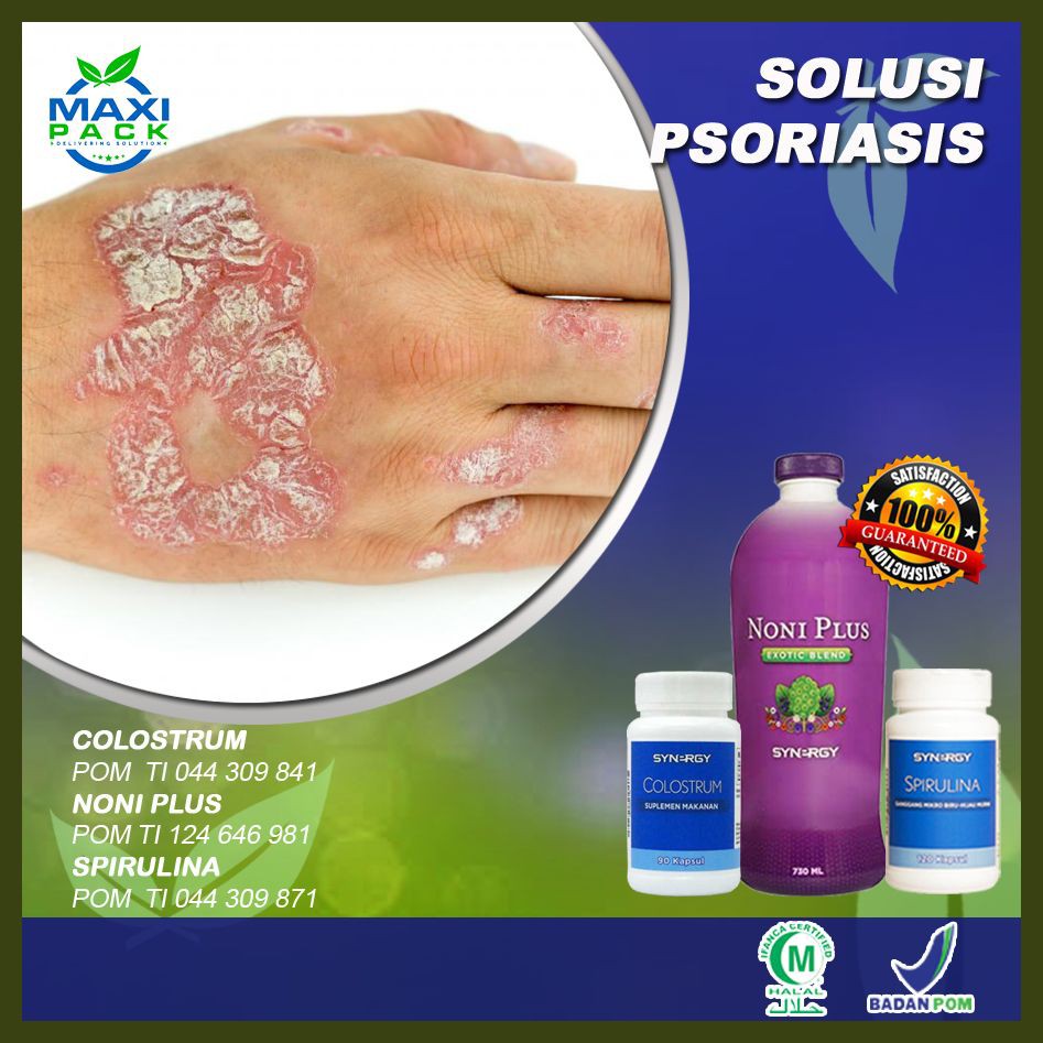 Herbal Obat Psoriasis Radang Kulit Maxipack Herbal