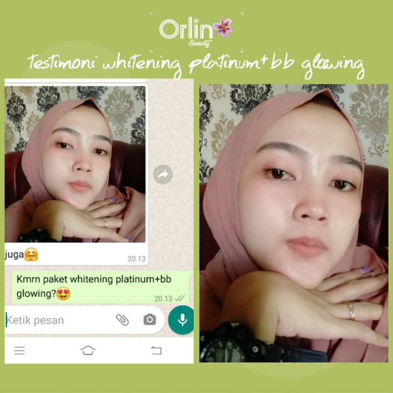 ORLIN/PAKET WHITENING PLATINUM/PAKET ORLIN/PAKET BRIGHTENING ORLIN/PEMUTIH WAJAH KULIT NOMAL/CREAM BPOM/SKINCARE BUMIL/SKINCARE BUSUI/ORLIN BEAUTY/BONUS GIFT-2