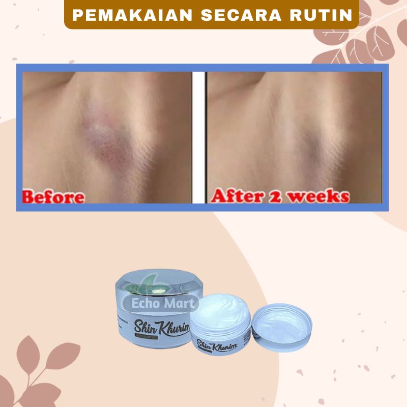 Cream Pemutih Pencerah Ketiak Selangkangan Ampuh BPOM Shin Kurim Shin Khurim Original Krim Pemutih Bokong Leher Sikut Lutut Leher Pantat Ketek Dengkul Siku Obat Lotion Memutihkan Lipatan Selangkangan Ketiak Hitam Membandel Permanen Underarm Ori