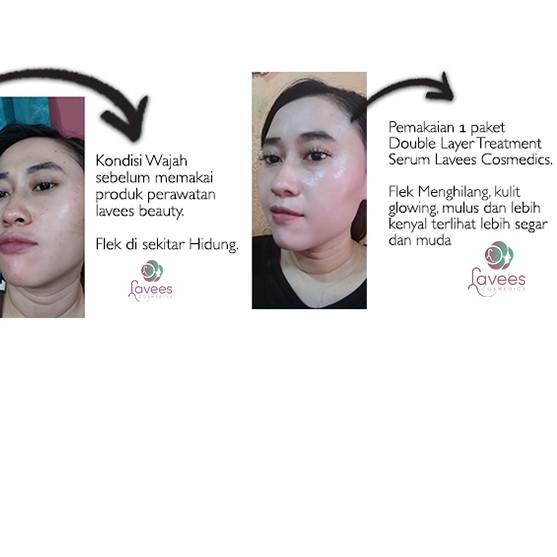 ♠ [SERUM FLEK & MELASMA] Lavees Concentrate Glowhite Serum Essence ♀