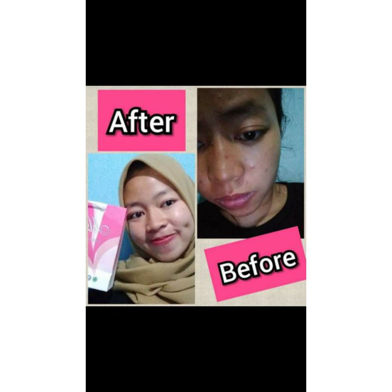 ORIGINAL PAKET PLATINUM MARWAH / ECER / KRIM MALAM PLATINUM / KRIM SIANG PLATINUM / SABUN CUCI MUKA / FACIAL WASH NORMAL / TONER / SKINCARE TERLARIS AMAN HALAL BPOM / PALING AMPUH CEPAT MENCERAHKAN KULIT NORMAL  FREE GIFT DISTRIBUTOR RESMI / OPEN RESELLER-8