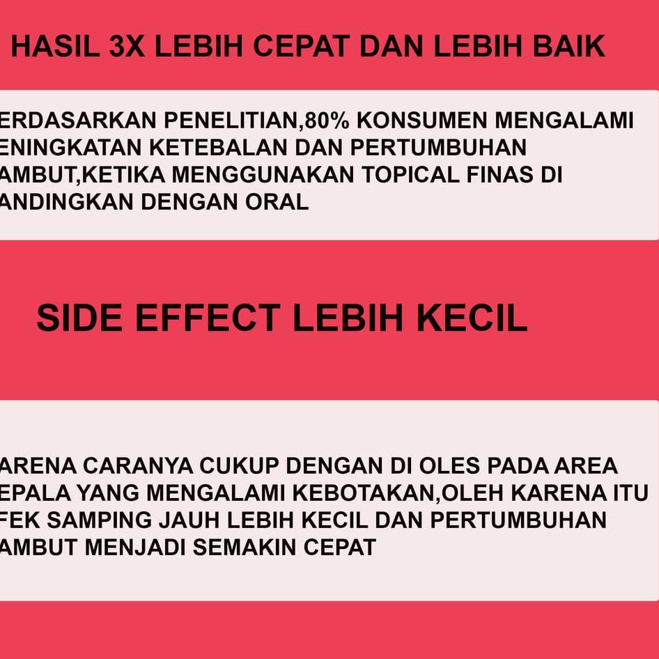 [KODE QHE89] FINMIX (TOPICAL FINASTERIDE + MINOXIDIL) PENUMBUH RAMBUT