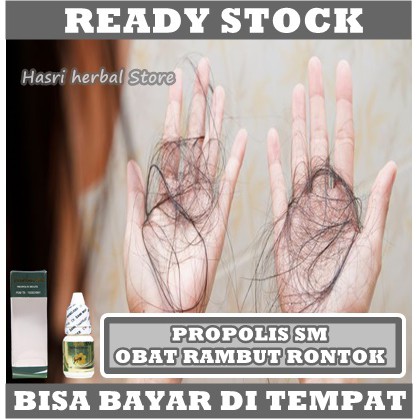 Obat Rambut Rontok Wanita &amp; Pria, Obat Ketombe Rambut, Obat Anti Rontok Rambut, Obat Ketombe Parah, Obat Mengurangi Rambut Rontok, Obat Penumbuh Rambut, Obat Ketombe Gatal Dengan Propolis SM 100% ASLI ORIGINAL