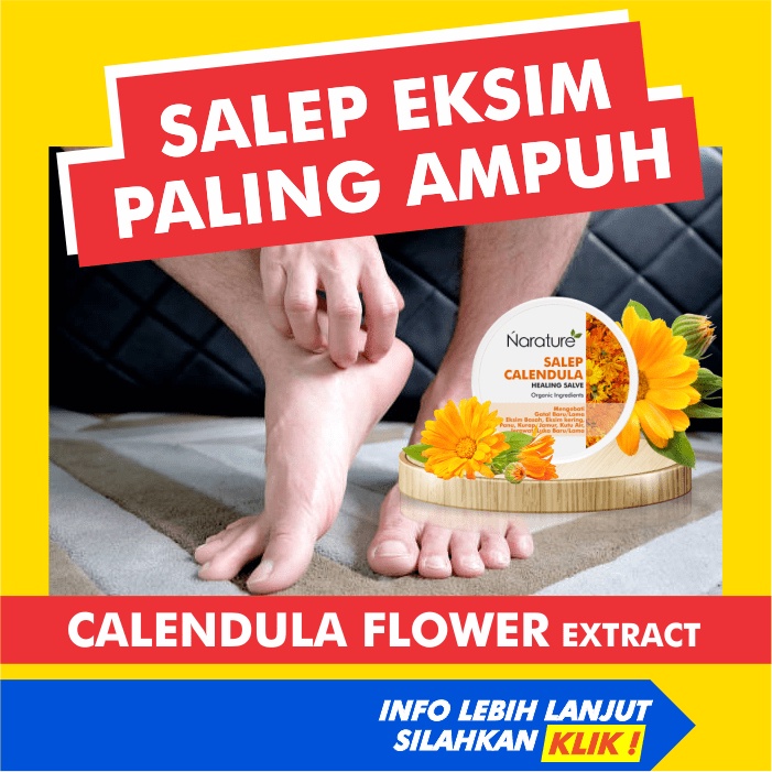 Narature Calendula Salve Salep Obat Gatal Eksim Kering Menahun Paling Ampuh Kulit Gatel Exim Basah P