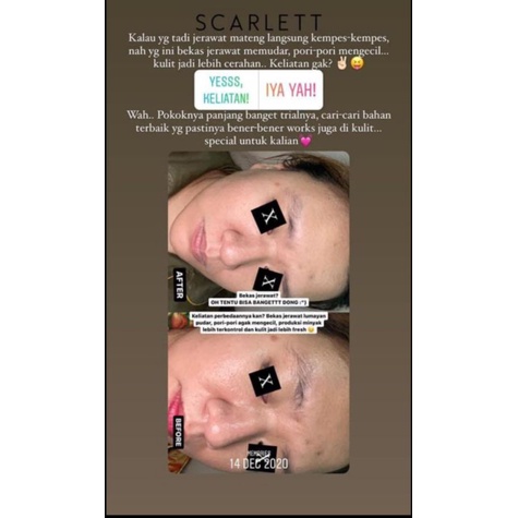 [ COD ] SCARLETT WHITENING FACE CARE / PERAWATAN WAJAH-4