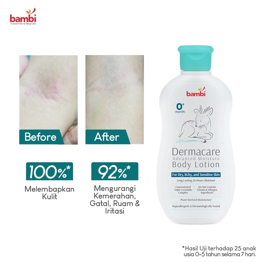 Bambi Dermacare Advanced Moisture Body Lotion Bayi