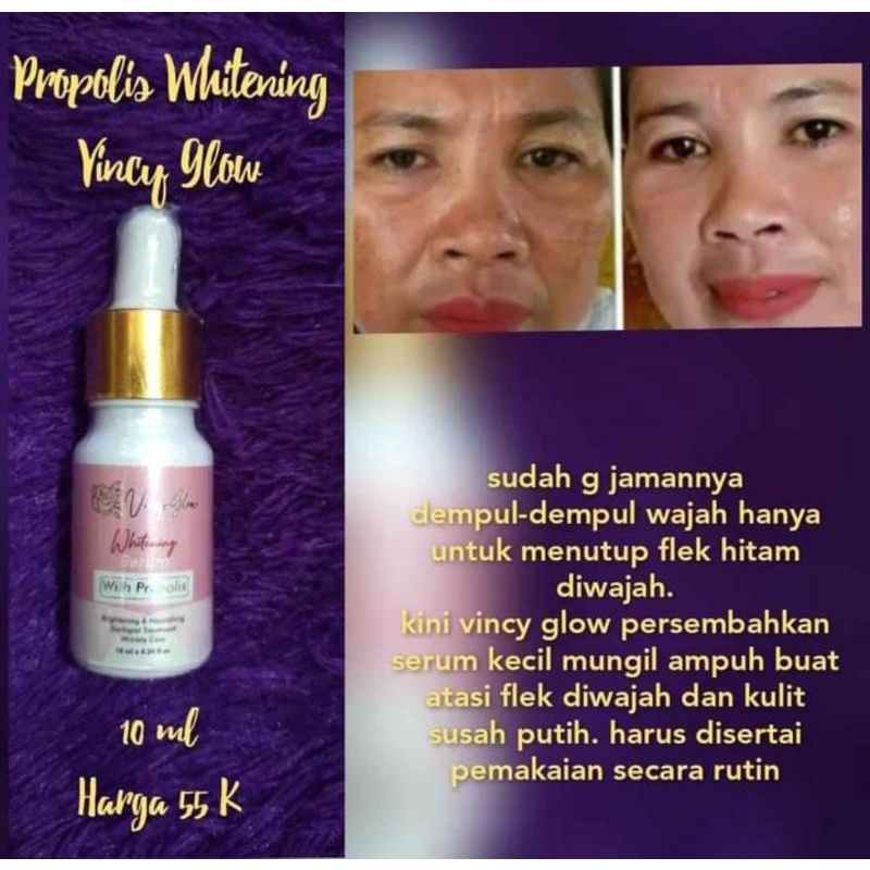 SERUM PROPOLIS VINCY GLOW