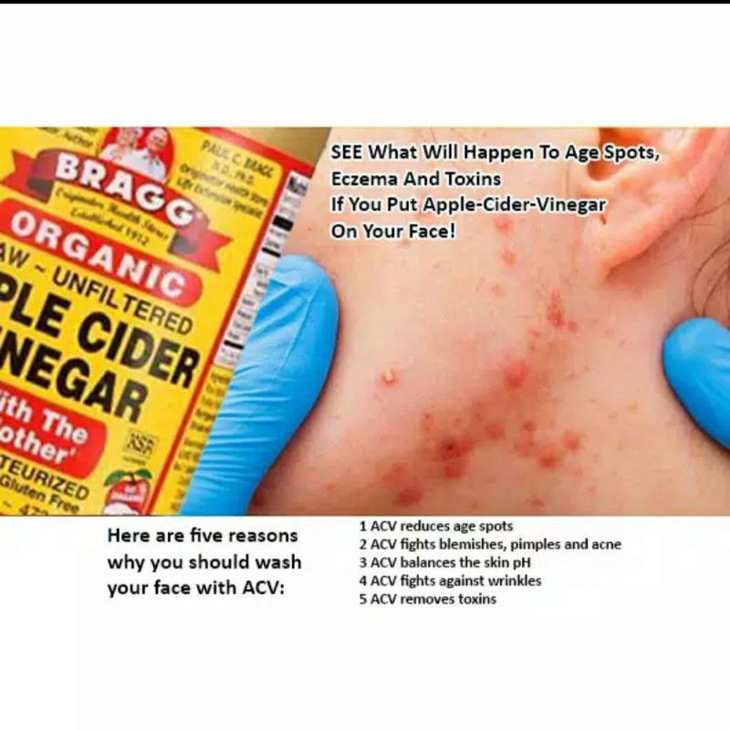 cuka apel murni bragg 60 milu