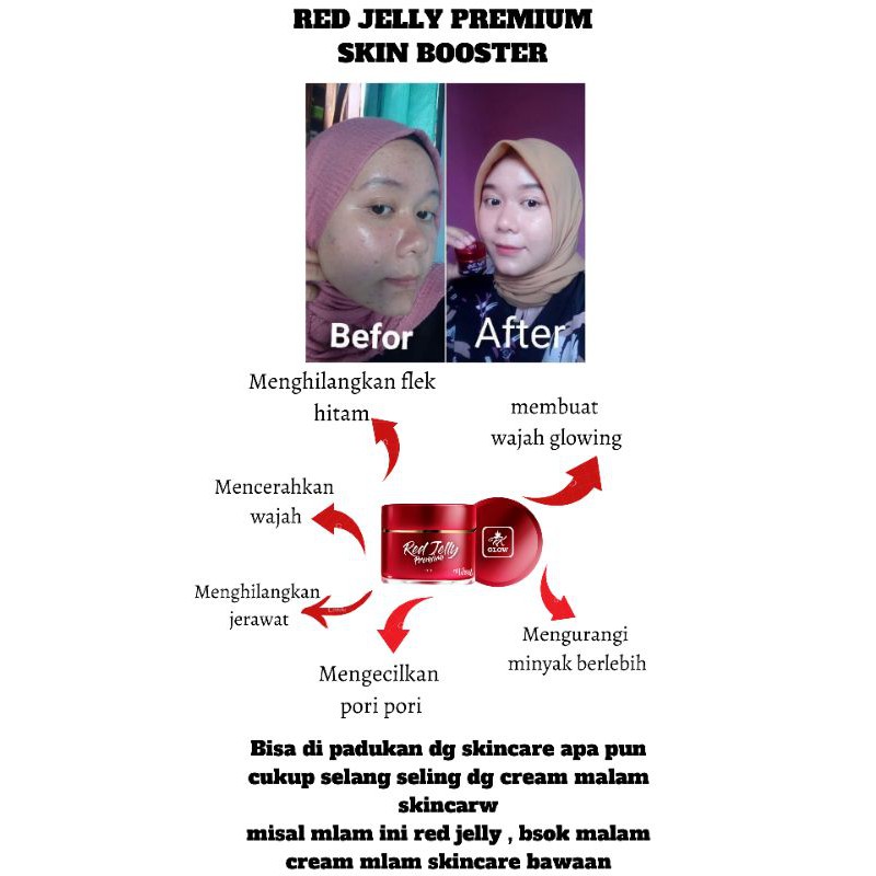 RED JELLY RK - RED JELLY PREMIUM - RED JELLY RK GLOW ORIGINAL BPOM