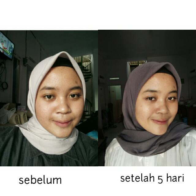 Cream Glowing / Cream Pemutih Wajah / Cream Wajah