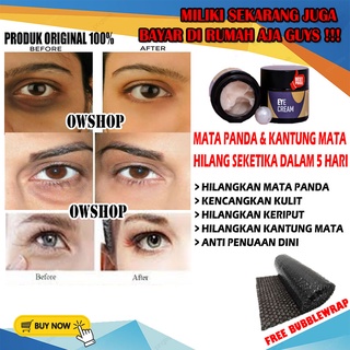 Jual Kantung Mata Hitam Harga Terbaik November 2021 Shopee Indonesia