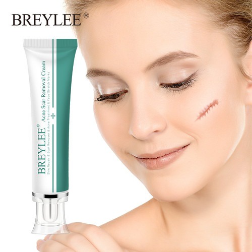 [BPOM] BREYLEE Acne &amp; Scar Marks Removal Spot Cream - Cream Penghilang Bekas Luka &amp; Jerawat