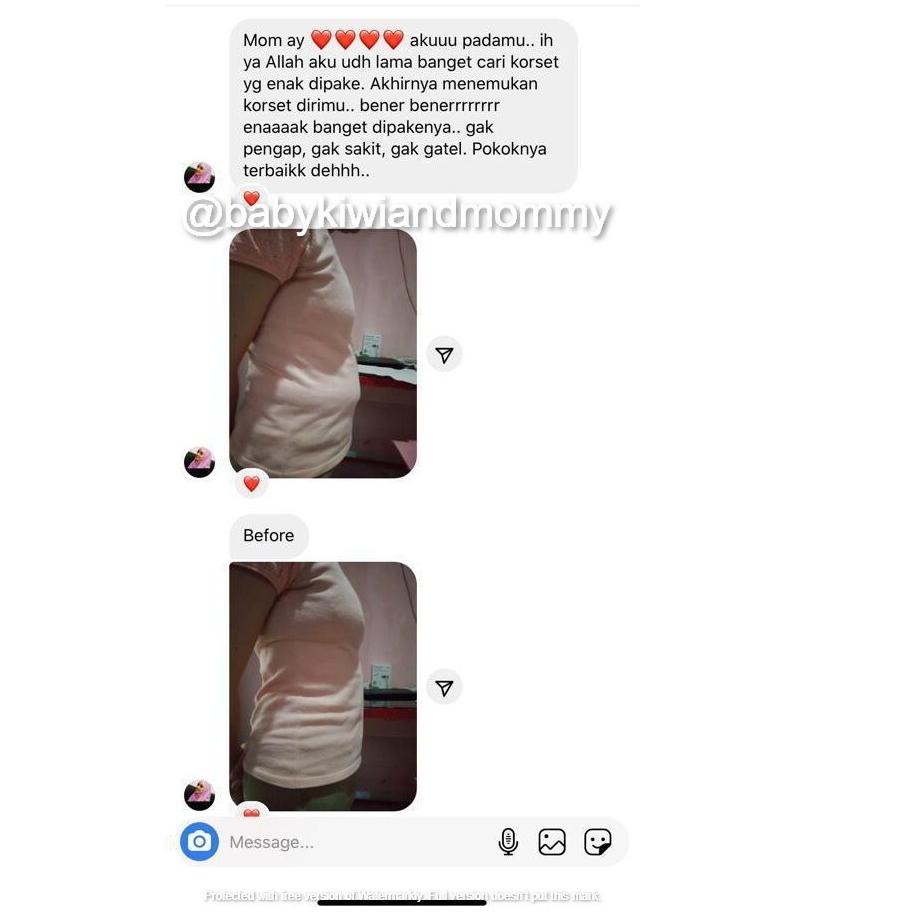 Berkualitas Ayree Breathable Corset / Korset Adem Nyaman Dipakai by Ayrianti 드