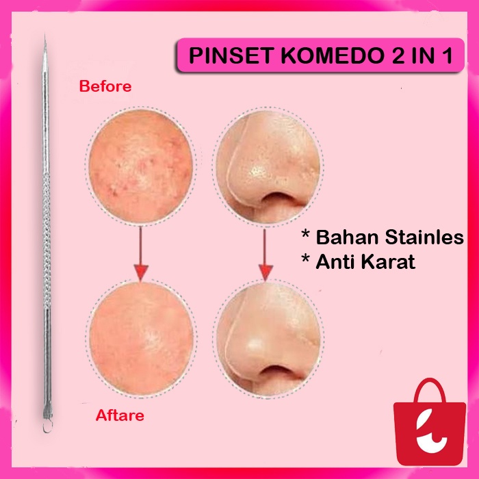 [Bisa COD] Pinset Komedo 2in1 Stainless Pinset Jerawat Alat Pencetan Pembersih Jerawat Komedo Facial Blackhead Acne Removal