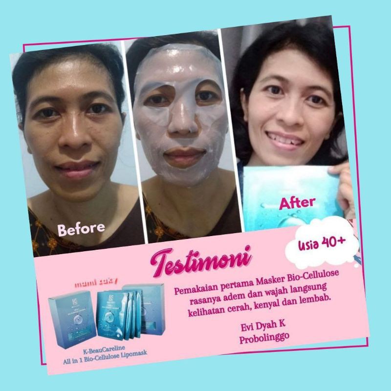 K-BeauCareline biocelulose lipomask