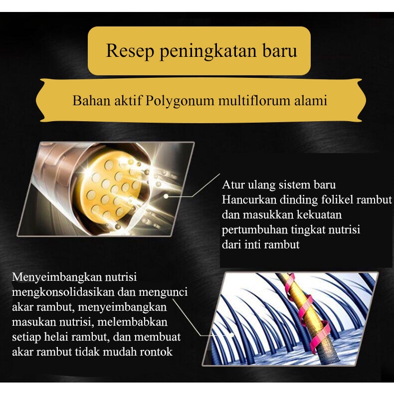 hair tonik 30ml penumbuh rambut/penumbuh rambut botak/serum penumbuh rambut/Memperbaiki folikel rambut/merangsang pertumbuhan rambut/perawatan rambut