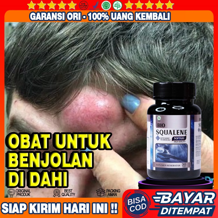 Obat Benjolan Di Dahi - Menghilangkan Benjolan Di Atas Alis - Obat Benjolan Di Jidat - Obat Alami Un