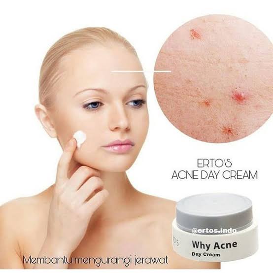 ERTOS WHY ACNE DAY CREAM TREATMENT SKINCARE BPOM KRIM SIANG PENGHILANG JERAWAT ORIGINAL BPOM