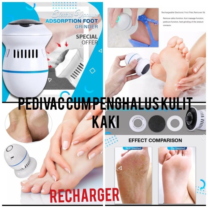 CEV Penghilang tumit pecah-pecah/callus remover -parutan kaki