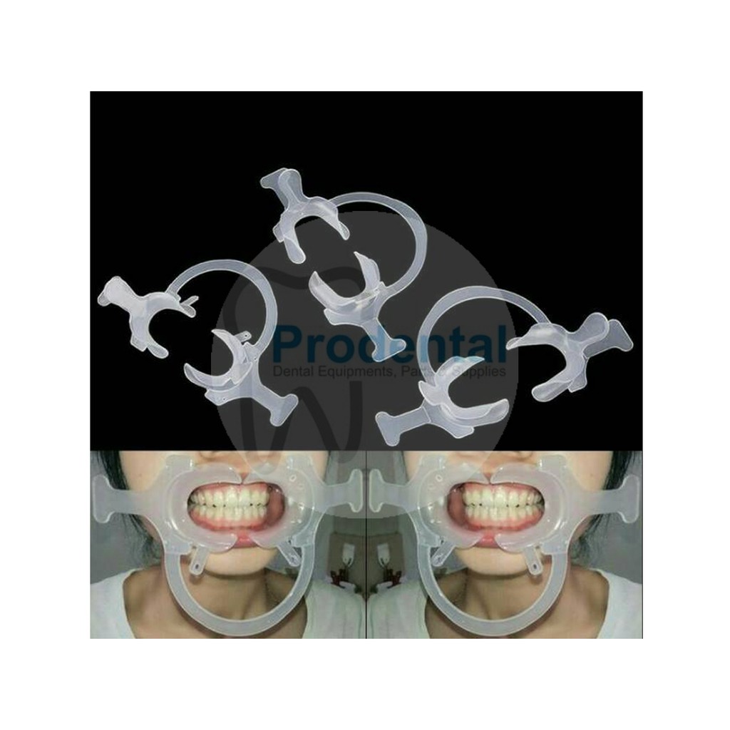 Lip Cheek Retractor / Pembuka Mulut / Mouth Gag Gate Opener With Handle Photography