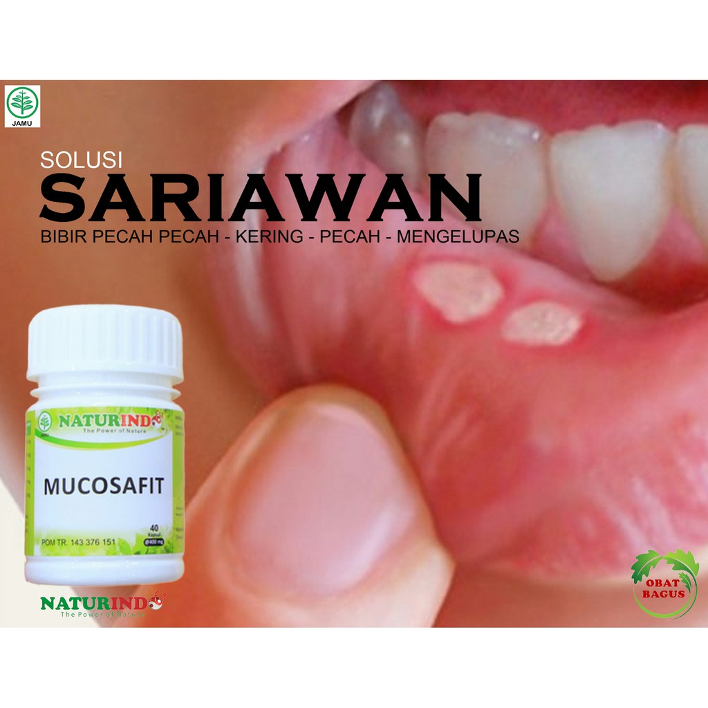 Obat Herbal Mengatasi Sakit Sariawan Bibir Pecah Pecah Bibir Kering Bibir Perih Bibir Mengelupas Shopee Indonesia