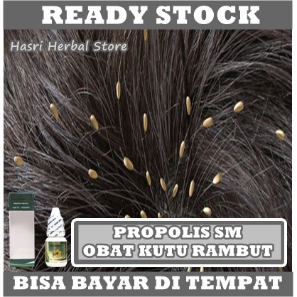 Obat Pembasmi Kutu Rambut Ramuan Herbal Alami / Obat Kutu Rambut dan Telurnya Anak Dewasa Herbal / Shampo Kutu Rambut / Sampo Anti Kutu / Obat Penghilang Kutu / Pembersih kutu - Dengan Herbal Propolis SM 100% Original Tanpa Efek Samping