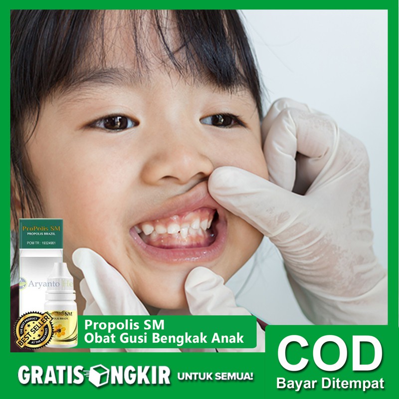 Obat Gusi Bengkak Anak Propolis Sm Brazilian