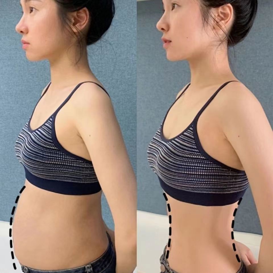 Koyo Pelangsing Slim Patch Pelangsing dan Detox Patch 10 tablet Patch pelangsing membakar lemak herbal botani untuk mengeluarkan racun dari tubuh