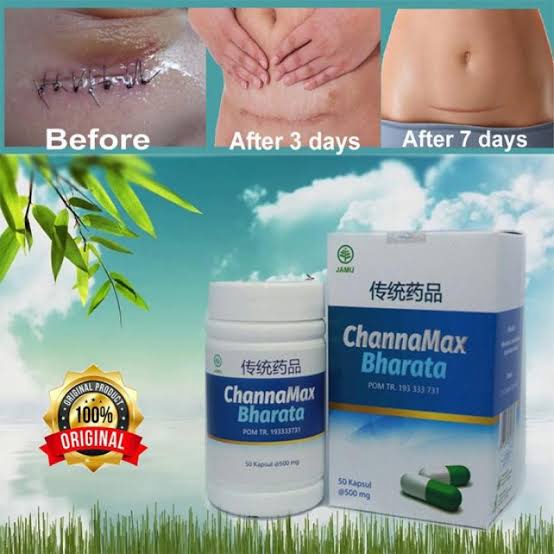 Obat Pengering Luka Ampuh ChannaMax Bharata | Penyembuh Semua Luka | Infeksi Luka Dalam dan Luka Lua