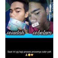 sabun kedas beauty, Pemutih Wajah, Badan ,Flek ,Ketiak ,Pria, Original-3
