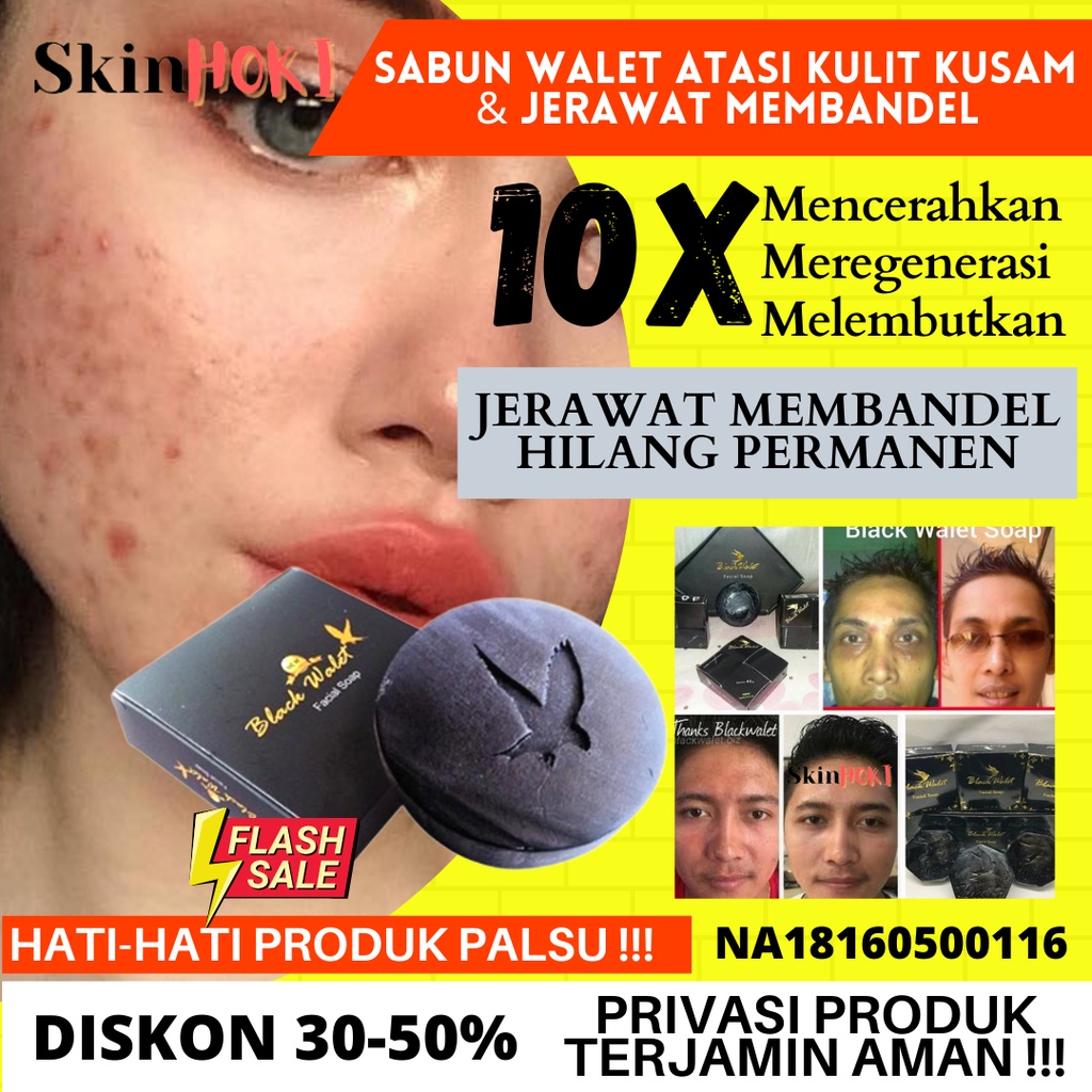 SABUN BATANG PEMUTIH WAJAH PENGHILANG BEKAS JERAWAT SABUN BLACK WALET ORIGINAL BPOM