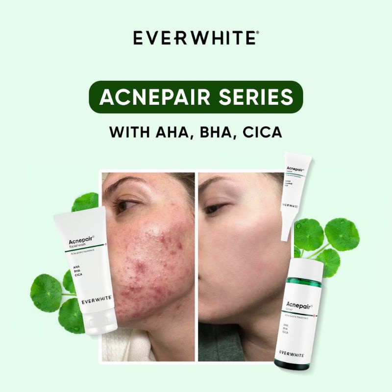 Everwhite Acnepair Cream 15gr l Acnepair Toner 100mL Acne Pair