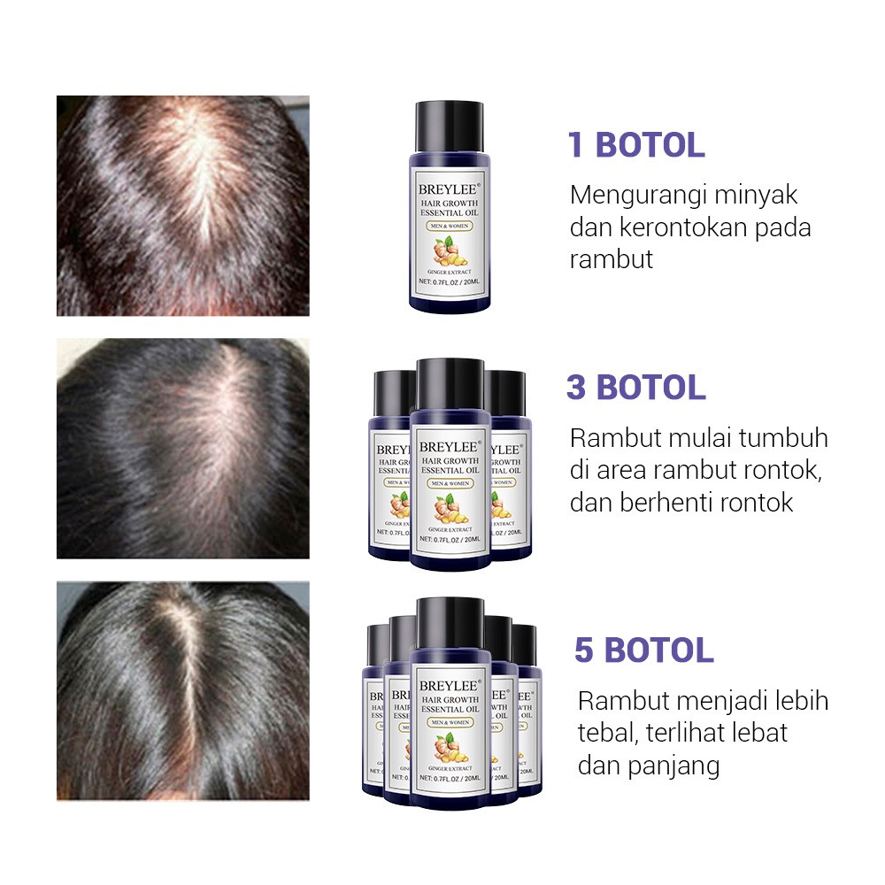 Serum Penumbuh Rambut Botak Breylee Hair Essential Oil - BREYLEE Serum Menyehatkan Kulit Kepala &amp; Meningkatkan Regenerasi Rambut (20ml)