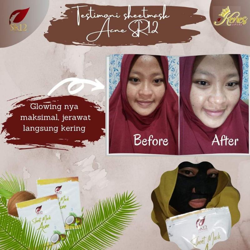 Sheet Mask SR12 - sheetmask brightening sr12 - sheetmask acne sr12 - Acne dan Brightening