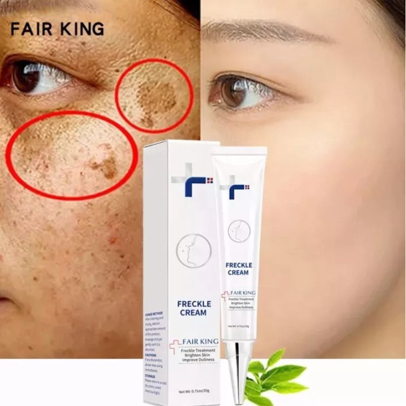 FAIR KING EFFECTIVE FRECKLE CREAM REMOVE DARK SPOT WHITENING CREAM FADE ACNE MELASMA-ANTI AGING SKIN LIGHTENING- CREAM PEMUTIH-KRIM PEMUTIH-WAJAH GLOWING KRIM-CREAM PENGHILANG FLEK-WAJAH CREAM SIANG MALAM-CREAM WAJAH GLOWING-20ml