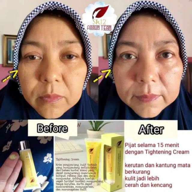 TIGHTENING CREAM SR12 / WHITENING TERBAIK / PENCERAH WAJAH / PENGENCANG ANTI KERUT WAJAH / HERBAL TIGHTENING CREAM SR12 / Krim hilangkan kerutan dalam 10 menit  Skin Tightening krim sr12