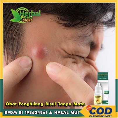 𝗢𝗕𝗔𝗧 𝗛𝗘𝗥𝗕𝗔𝗟 𝗕𝗜𝗦𝗨𝗟 - Obat Oles Bisul - Penghilang Bisul Tanpa Mata Gatal dan Panas Benjolan di Lutut,