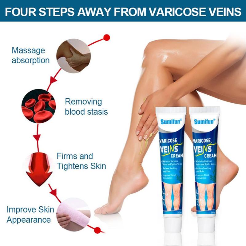 Salep Varises Cream Varicose Veins Obat Varises Kemaluan Bengkak Benjolan Buah Zakar Nyeri Testis Varicose Veins Cream 20Gr
