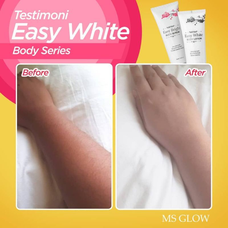MS Glow Hand Body 100% original bisa cod