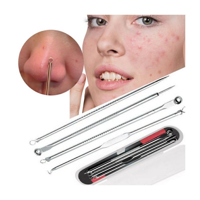 Alat Pencet Komedo &amp; Jerawat Pinset 1 Set Isi 4 Pcs / PIMPLE PICK / SENDOK UNA BLACKHEAD  BLACKHEADS