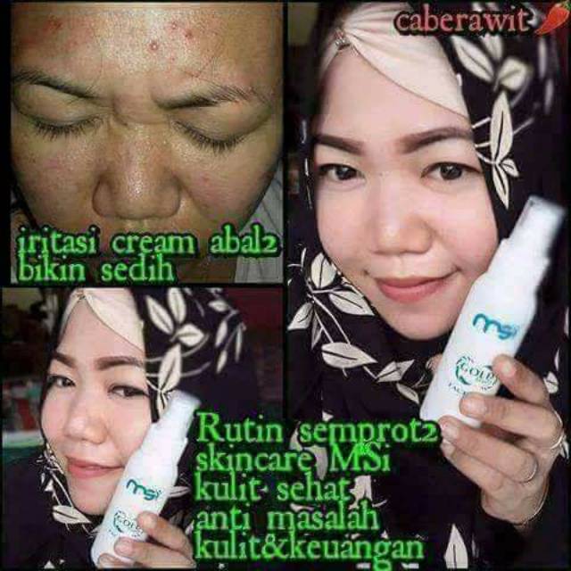 46+ Manfaat face mist msi untuk jerawat ideas