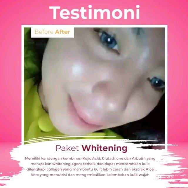 Paket whitening ms glow free pouch