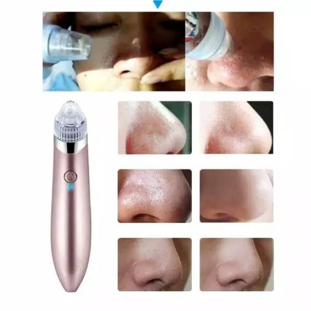 NS Alat Sedot Komedo JB8620 Acne Pore - Pink