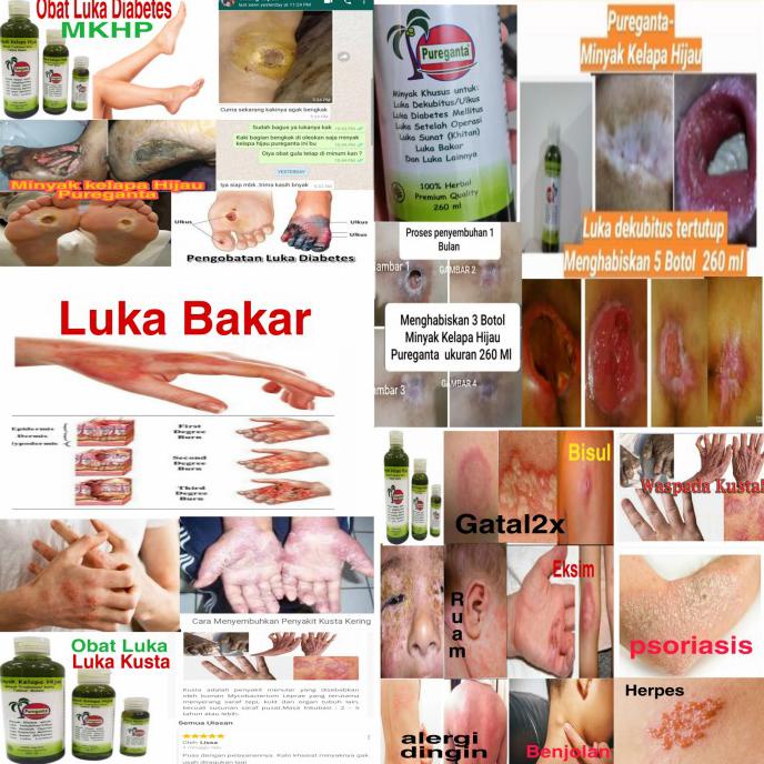 

Dapur/ Pureganta 300 Ml ( Minyak Kelapa Hijau Tradisional Karo ) - 260 Ml