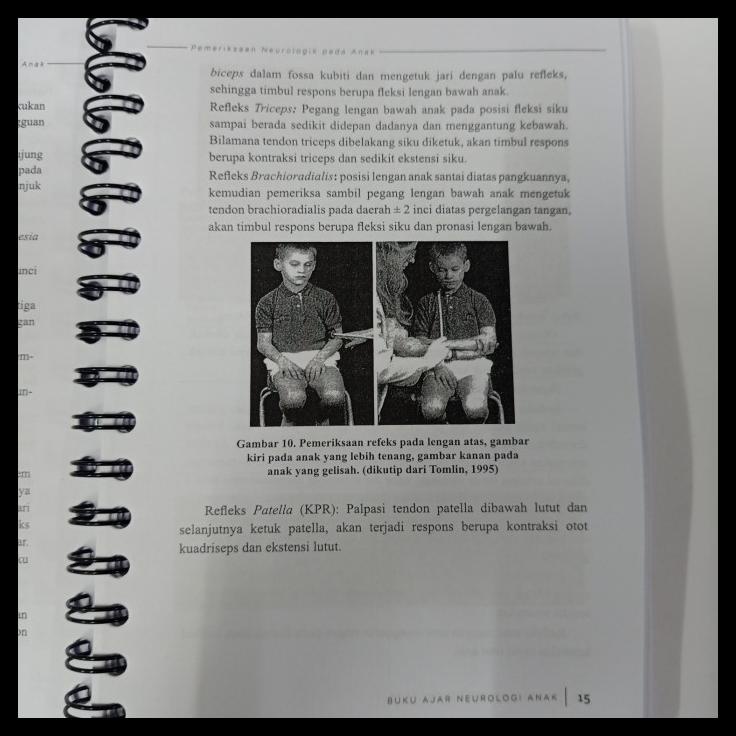 

TERBARUU!! Buku Kedokteran Buku Ajar Neurologi Anak COD