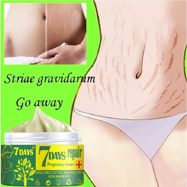 Stretch Mark Penghilang Kerutan Di Perut dan Kaki 7 Days