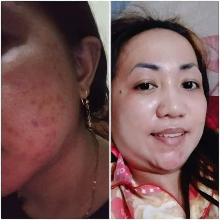 Ratu Glow Skincare BPOM Viral PAKET CREAM WAJAH Glowing series Paket Normal Flek Jerawat bopeng |skincare pelicin wajah-4