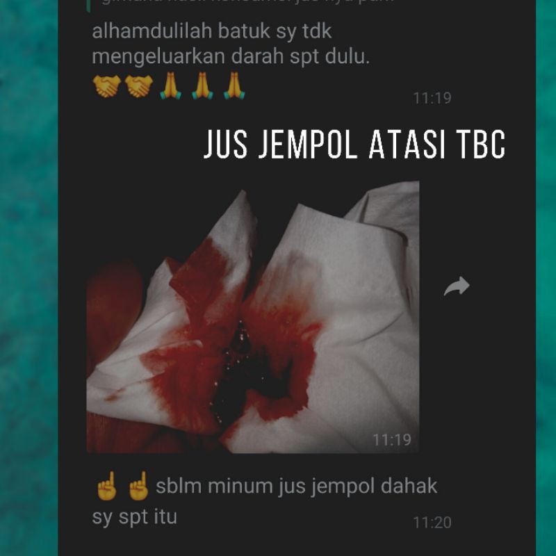 Herbal jus bawang tunggal 500ml COD kesemutan tbc ginjal batu empedu asam lambung asma hepatitis pengapuran sakit paru vertigo saraf kejepit sakit saat haid nyeri sendi sakit pinggang vertigo bronchitis impotensi sesak nafas pengapuran ampuh manjur alami-8