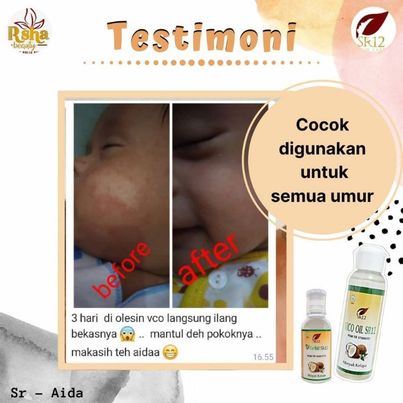 Virgin Coconut Oil | MINYAK KELAPA MURNI | VICO SR12 | VCO SR12  | penggemuk pelangsing obat jerawat